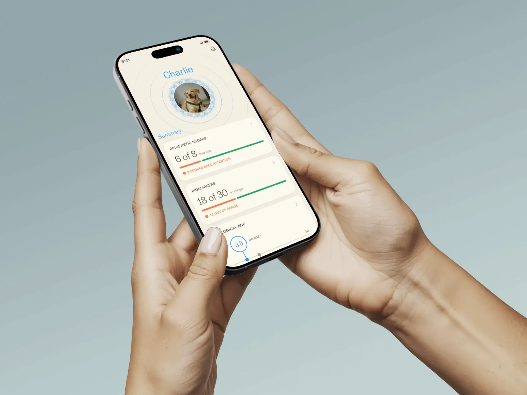 Two hands holding a phone showing the Omi app's Charlie summary screen with cellular aging scores, biomarkers and biological age
